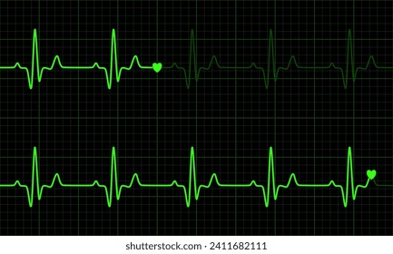 Green heart graph on green and black background. Normal sinus rhythm. Vital Sign. Vector Medical Illustration.