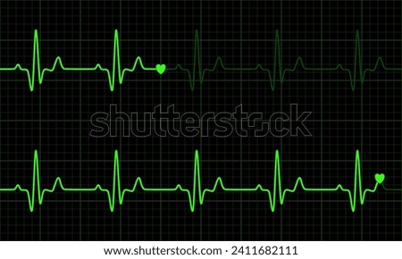 Green heart graph on green and black background. Normal sinus rhythm. Vital Sign. Vector Medical Illustration.