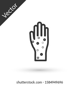 Grey line Hand with psoriasis or eczema icon isolated on white background. Concept of human skin response to allergen or chronic body problem.  Vector Illustration