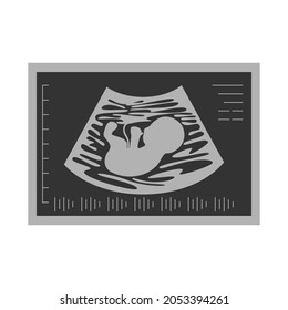 grey ultrasound picture of fetus. concept of baby in womb mother, pregnancy and health, examination procedure of embryo, placenta, umbilical cord. emblem for gestational center. simple sign on white background