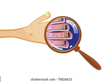 Groomed hand under a magnifying glass. Dirty fingernails. Nail fungus. Isolated comical picture.