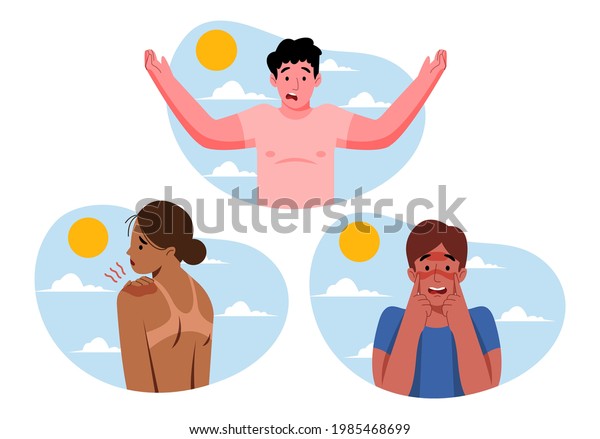 Group of different people with a sunburn
Vector illustration.