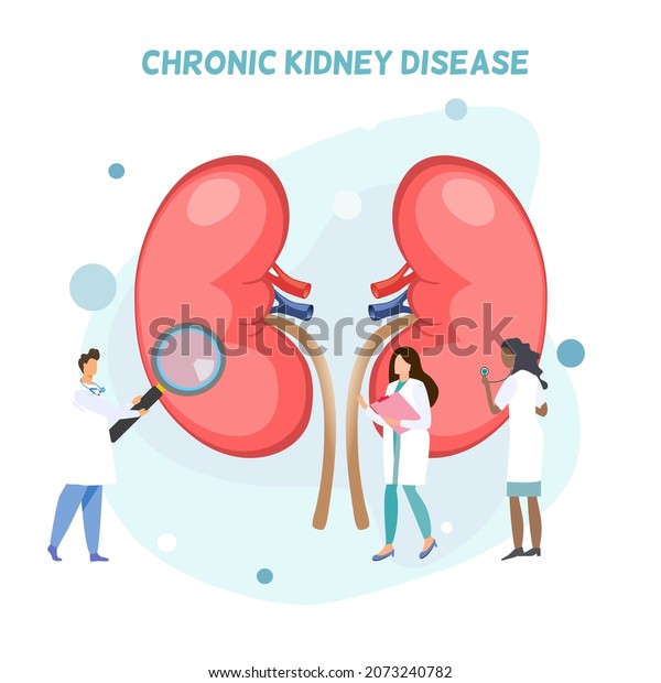 Group of doctors doing activities around human\
kidneys, diagnosis o about kidney disease, chronic kidney disease,\
long term illness, a lady doctor using stethoscope, a doctor\
holding magnifying glass