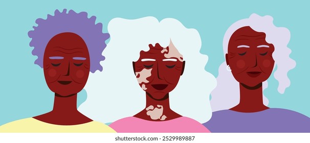 Group of natural African senior women with varied skin and vitiligo as imperfect perfection concept, premium flat vector stock illustration