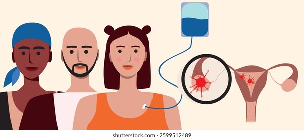 Group of people, uterine cancer patients with metastases, flat vector stock illustration as cancer control concept