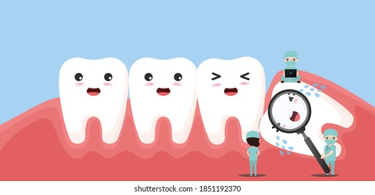 Group of small dentists are caring for a large tooth. Impacted wisdom tooth character pushing adjacent teeth causing inflammation, toothache, gum pain.vector, illustration