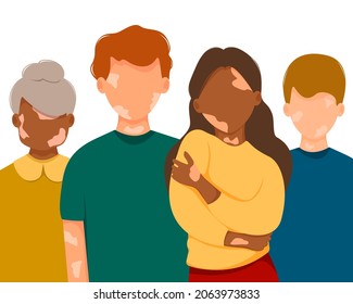 Group of vitiligo people isolated on white background. Concept of skin depigmentation, body positive. World vitiligo day. 