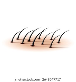 Crescente cabelo humano preto close-up realista ilustração vetor 3d emergindo da pele, para dermatologia, tricologia, depilatórios cosméticos, transplante de cabelo, cartaz médico ou design de banner.