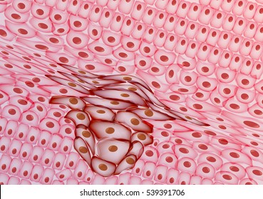 Growing Tumor, Tissue Section - Vector Illustration