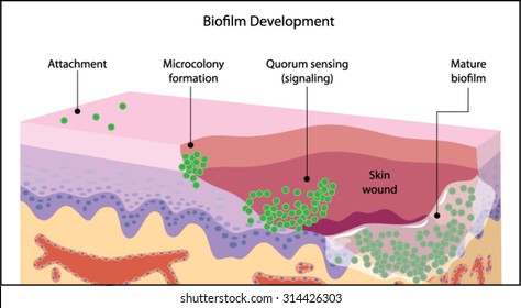 Growth of a bacterial biofilm on a skin wound, from initial attachment through microcolony formation, signalling and mature biofilm