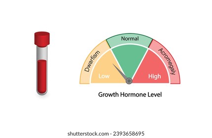 Wachstumshormonspiegel. Somatotropin. Zwergkunst und Akromegalie. Vektorgrafik.  