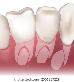 Growth of permanent teeth. Baby teeth or milk tooth. Anatomical  illustration with molars and incisors. Permanent tooth located below primary tooth