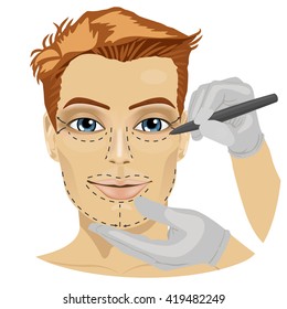 Guide lines for surgical incisions on a patient male face