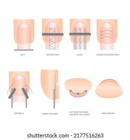 Anleitung zur professionellen Maniküre, Vektorgrafik, Infografiken. Ausbildung von Meistern der Maniküre. Handbuch für Gel-Nagellack