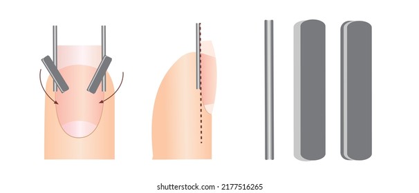 Anleitung zur professionellen Maniküre, Vektorgrafik, Infografiken. Ausbildung von Meistern der Maniküre. Handbuch für Gel-Nagellack