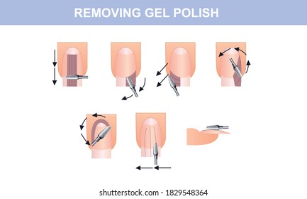 Guide to removing gel polish, a guide to manicure. Vector illustration