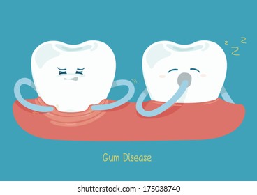 Gum disease