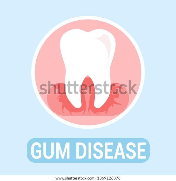 Gums Disease Dentistry Flat Banner Vector Stock Vector (Royalty Free