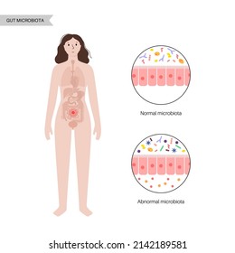 Gut brain connection, dysbiosis concept. Microbiome in the human body. Signals from brain to the digestive tract. Enteric nervous system, intestine anatomy. Colon and cerebrum flat vector illustration