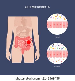 Gut brain connection, dysbiosis concept. Microbiome in the human body. Signals from brain to the digestive tract. Enteric nervous system, intestine anatomy. Colon and cerebrum flat vector illustration