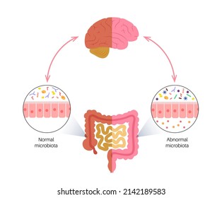 Gut brain connection, dysbiosis and microbiome. Normal and abnormal microbiota. Enteric nervous system, intestine anatomy. Signals from brain to digestive tract. Colon and cerebrum vector illustration