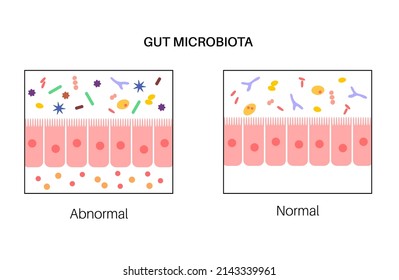 Gut brain connection, dysbiosis and microbiome. Surface area of intestinal walls, intestine anatomy. Intestinal villi, cross section, villus and epithelial cells. Colon and bowel vector illustration.