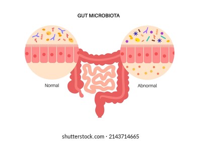 Gut brain connection, dysbiosis and microbiome. Surface area of intestinal walls, intestine anatomy. Intestinal villi, cross section, villus and epithelial cells. Colon and bowel vector illustration.