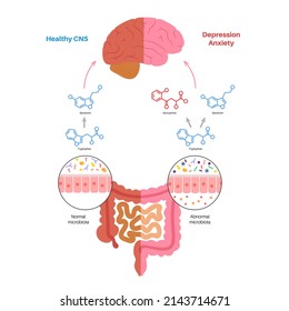 Gut brain connection, dysbiosis and microbiome. Healthy CNS and depression anex. Enteric nervous system, intestine anatomy. Signal from brain to digestive tract. Colon and cerebrum vector illustration