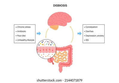 Gut brain connection, dysbiosis and microbiome. Normal and abnormal microbiota. Enteric nervous system, intestine anatomy. Signals from brain to digestive tract. Colon and cerebrum vector illustration