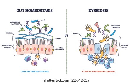 Gut homeostasis and dysbiosis immune response differences outline diagram. Labeled educational scheme with functional barrier and defect side view vector illustration. Tolerant and dysregulated flora.
