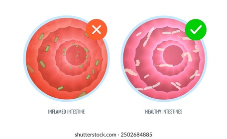 Darmwände mit Bakterien und probiotischen Abbildungen des Schleims. Detaillierter Nahquerschnitt Darm - Element für infografische medizinische Illustrationen, Gesundheitserziehung und Anatomiestudien