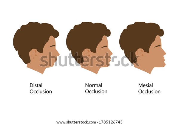 Vector De Stock Libre De Regalias Sobre Tipo Con Perfil De Picadura Distal 1785126743