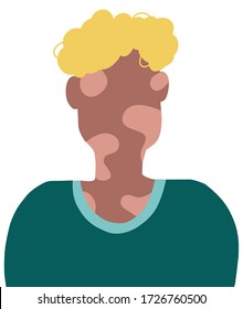 The guy with vitiligo. Illustration. vector. Portrait