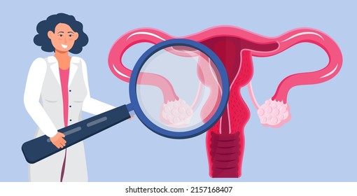 Gynecologist looks through a magnifying glass, concept vector for medical blog. Family planning, pregnancy, infertility treatment, Endometriosis, endometrium illustration.