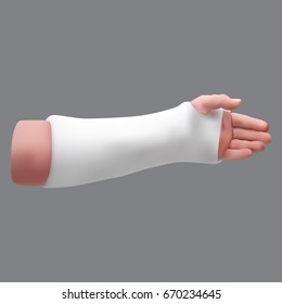 Gypsized broken arm. Isolated realistic object. Vector illustration.