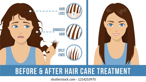 Hair care. Common problems - split ends, damaged hair, hair loss. Before and after hair care treatment. Vector