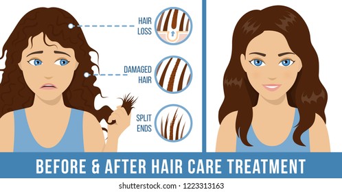 Hair care. Common problems - split ends, damaged hair, hair loss. Before and after care treatment. Vector