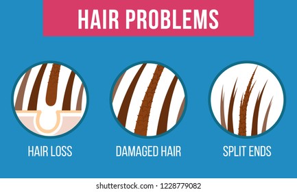 Hair care. Common problems - split ends, damaged, hair loss. Vector