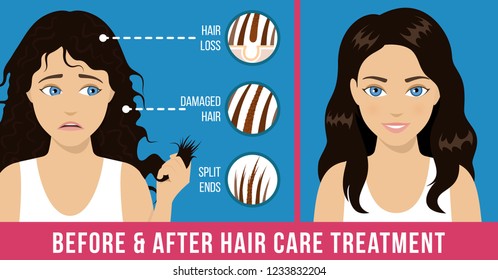 Hair care. Common problems - split ends, damaged hair, hair loss. Before and after care treatment. Vector