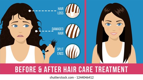 Hair care. Common problems - split ends, damaged hair, loss. Before and after hair care treatment. Vector