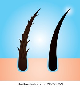 Hair care, prevent split ends vector illustration