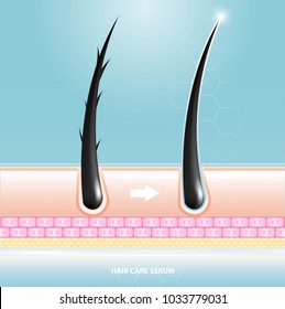 Hair care serum follicle diagnostics. Anatomy skin, medical human, epidermis layer, vector illustration design.