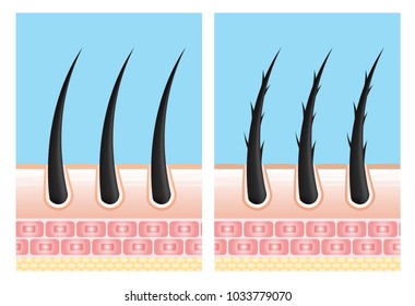 Hair care serum follicle diagnostics. Anatomy skin, medical human, epidermis layer, vector illustration design.