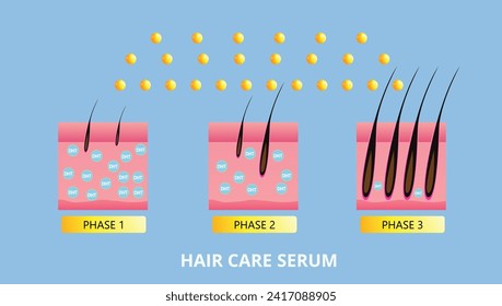 Hair care serum , hair Transplantation, vector design