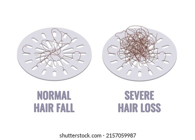 Pisos de pelo atascados en las rejillas de drenaje de la ducha. Caída normal del cabello versus pérdida severa del cabello. Concepto de síntoma de alopecia. Ilustración vectorial de dibujos animados