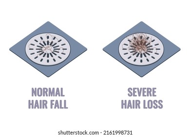 Hair clumps stuck in the shower drain grids. Normal hair fall versus severe hair loss. Alopecia symptom concept. Cartoon vector illustration