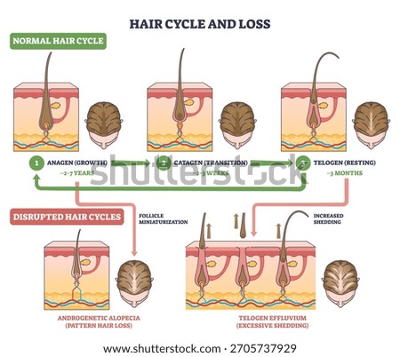 Hair cycle and loss visual explains anagen, catagen, telogen and how disruption causes shedding, key objects, follicles, scalp sections, arrows. Outline diagram