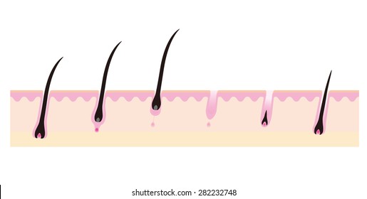 Hair cycle,slow