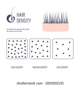 Hair density types classification set. Low, medium, high hair volume on scalp. Anatomical strand structure linear scheme. Outline vector illustration. 