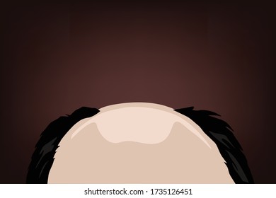 Hair falling problem of old Asian man